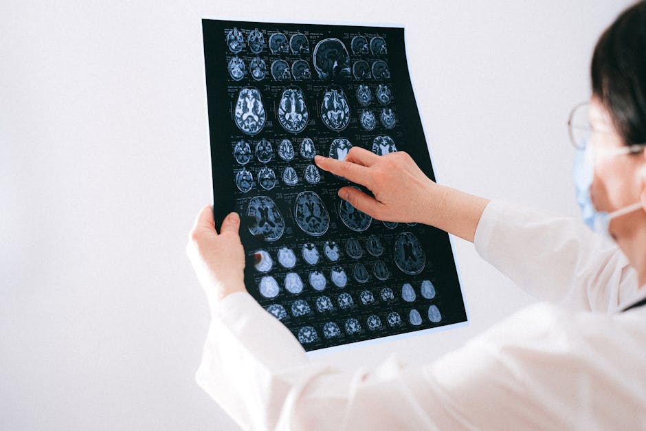 Síntomas de la displasia cortical